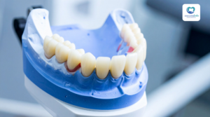 Regular Dental Check Up 