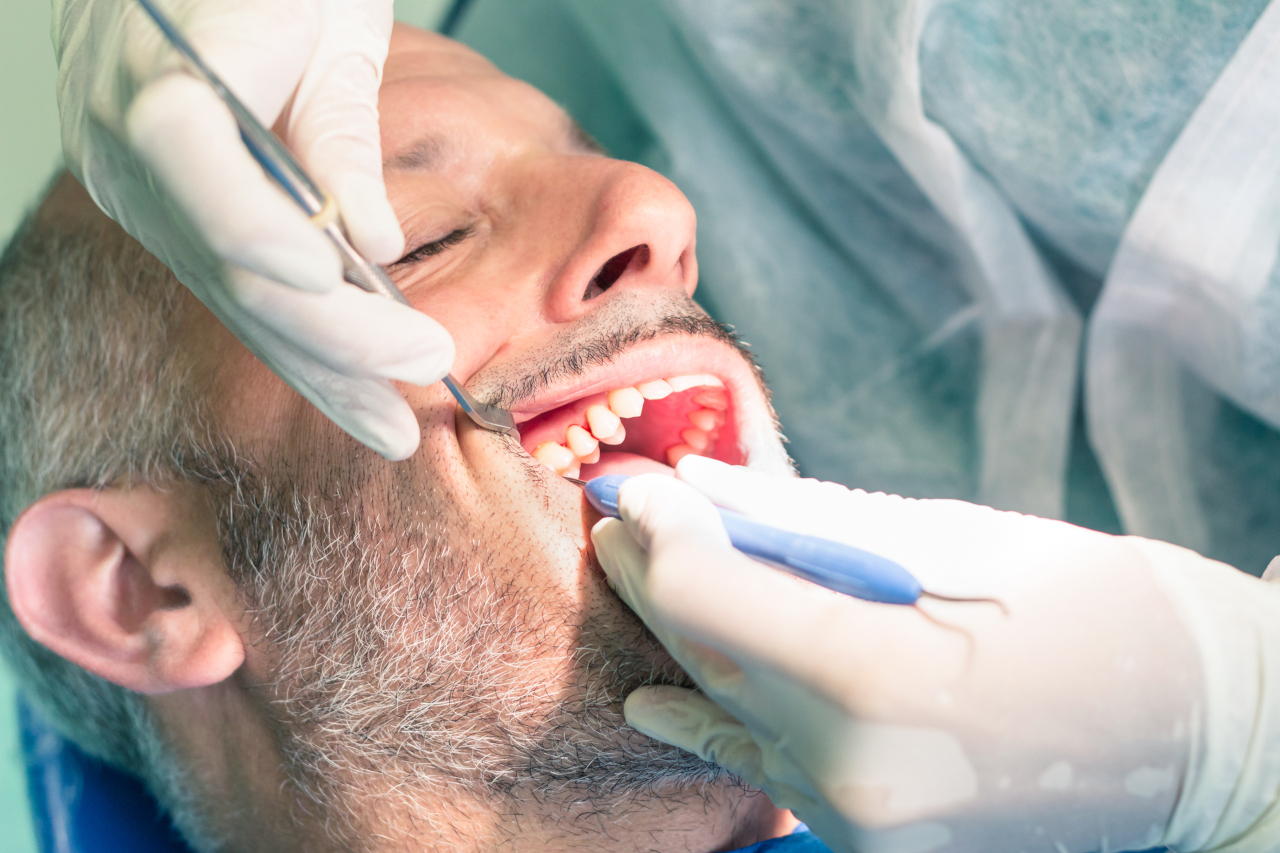 Do I Need a Dental Filling? 8 Signs a Cavity May Need Treatment